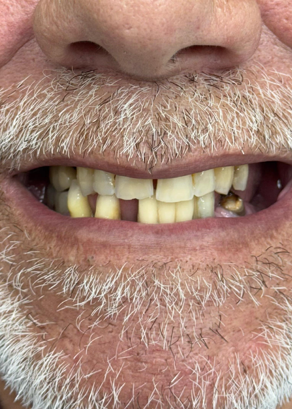After