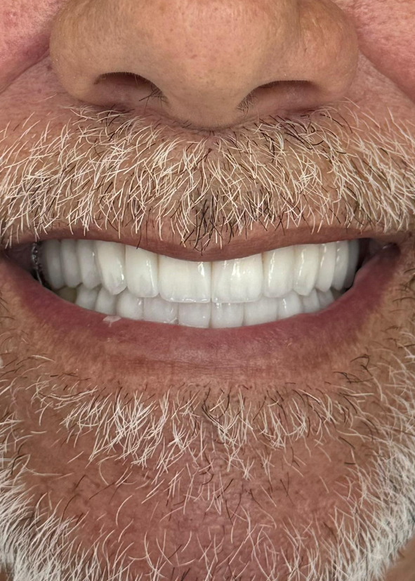 Before