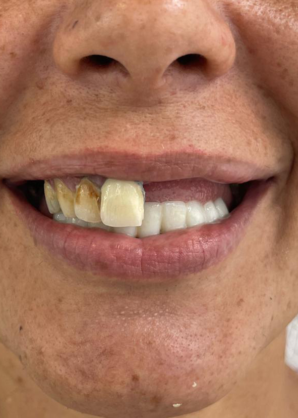 After